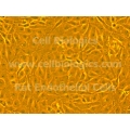 ZDF Rat Diabetic Kidney Glomerular Endothelial Cells